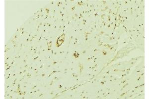 ABIN6276740 at 1/100 staining Mouse brain tissue by IHC-P. (THRB Antikörper  (Internal Region))