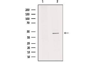 Western blot analysis of extracts from rat brain, using IL11RA Antibody.