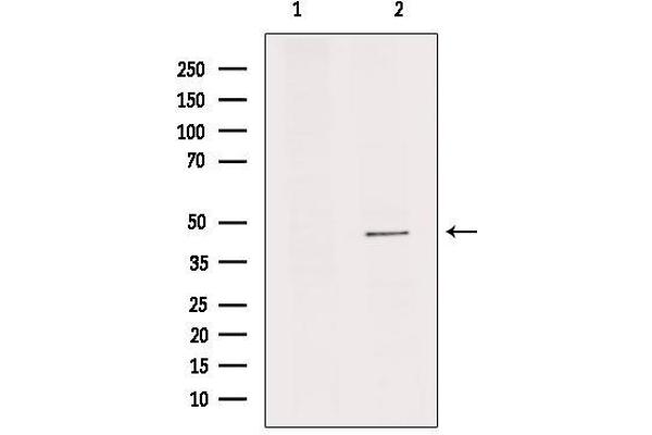 IL11RA Antikörper  (C-Term)