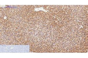 Immunohistochemistry of paraffin-embedded Rat liver tissue using FN1 Monoclonal Antibody at dilution of 1:200.