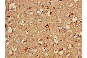 Immunohistochemistry of paraffin-embedded human brain tissue using ABIN7149167 at dilution of 1:100 (COX5A Antikörper  (AA 42-150))