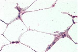 Immunohistochemistry (IHC) image for anti-Uncoupling Protein 2 (Mitochondrial, Proton Carrier) (UCP2) (Internal Region) antibody (ABIN5539644)