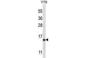 NR2C2AP Antibody (N-term) western blot analysis in Y79 cell line lysates (35µg/lane). (NR2C2AP Antikörper  (N-Term))