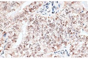 Immunohistochemistry (Paraffin-embedded Sections) (IHC (p)) image for anti-RNA Binding Motif Protein 3 (RBM3) antibody (ABIN7261874)