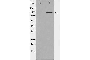 Western blot analysis on Jurkat cell lysate using MAST3 Antibody,The lane on the left is treated with the antigen-specific peptide.