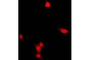 Immunofluorescent analysis of ZNF397 staining in HepG2 cells. (ZNF397 Antikörper  (N-Term))