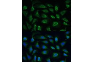 Immunofluorescence (IF) image for anti-Secreted Protein, Acidic, Cysteine-Rich (Osteonectin) (SPARC) (AA 18-303) antibody (ABIN7270183)