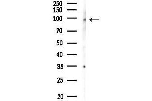 anti-Matrix Extracellular phosphoglycoprotein (MEPE) antibody
