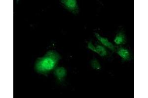 Anti-SDS mouse monoclonal antibody (ABIN2455350) immunofluorescent staining of COS7 cells transiently transfected by pCMV6-ENTRY SDS (RC217814).