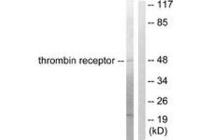 Western blot analysis of extracts from HeLa cells, treated with Nocodazole 1ug/ml 18h, using Thrombin Receptor Antibody. (PAR1 Antikörper  (AA 10-59))