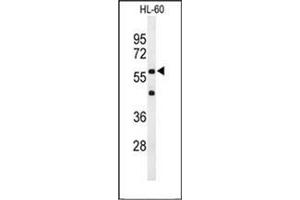 Western blot analysis of CD132 / IL2RG Antibody (N-term) in HL-60 cell line lysates (35ug/lane).