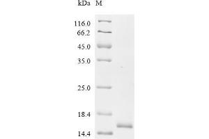 Epidermal Growth Factor (EGF) (AA 971-1023) protein (His tag)