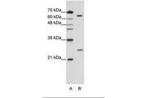 Image no. 2 for anti-Nudix (Nucleoside Diphosphate Linked Moiety X)-Type Motif 21 (NUDT21) (N-Term) antibody (ABIN202092) (NUDT21 Antikörper  (N-Term))