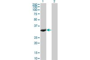 Western Blot analysis of FBXO6 expression in transfected 293T cell line by FBXO6 monoclonal antibody (M01), clone 3F10. (FBXO6 Antikörper  (AA 1-293))