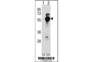 Western blot analysis of DARS using rabbit polyclonal DARS Antibody using 293 cell lysates (2 ug/lane) either nontransfected (Lane 1) or transiently transfected (Lane 2) with the DARS gene. (DARS Antikörper  (N-Term))