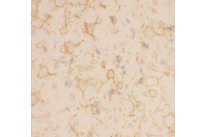Immunohistochemistry (IHC) image for anti-Potassium Voltage-Gated Channel, Shab-Related Subfamily, Member 1 (KCNB1) (AA 687-858) antibody (ABIN3043866)