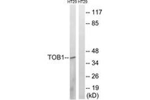 Western blot analysis of extracts from HT-29 cells, treated with serum 20% 15', using TOB1 (Ab-164) Antibody. (Protein Tob1 (TOB1) (AA 130-179) Antikörper)
