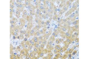 Immunohistochemistry of paraffin-embedded Human liver using IL20 Polyclonal Antibody at dilution of 1:100 (40x lens). (IL-20 Antikörper)