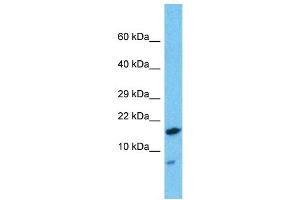 Western Blotting (WB) image for anti-HD Domain Containing 2 (HDDC2) (N-Term) antibody (ABIN2787774) (HDDC2 Antikörper  (N-Term))