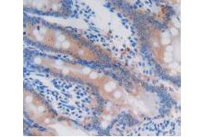 Figure. (GSTA4 Antikörper  (AA 2-222))