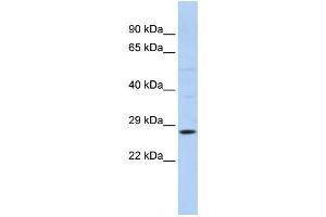 Western Blotting (WB) image for anti-RAB38, Member RAS Oncogene Family (RAB38) antibody (ABIN2458672) (RAB38 Antikörper)