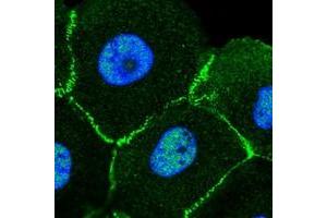Immunofluorescent staining of human cell line A-431 with MLLT4 polyclonal antibody  at 1-4 ug/mL dilution shows positivity in nucleus but not nucleoli, plasma membrane and cell junctions.