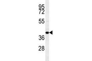 CCR8 antibody western blot analysis in MDA-MB435 lysate (CCR8 Antikörper  (AA 290-317))