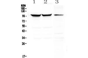 Western blot analysis of Dynamin 1 using anti-Dynamin 1 antibody . (Dynamin 1 Antikörper  (AA 616-667))