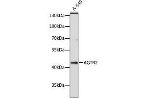 Western Blotting (WB) image for anti-Angiotensin II Receptor, Type 2 (AGTR2) (AA 250-350) antibody (ABIN7265597)