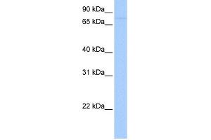 WB Suggested Anti-SAMD4A Antibody Titration: 0. (SAMD4A Antikörper  (Middle Region))