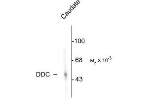 Image no. 1 for anti-Dopa Decarboxylase (Aromatic L-Amino Acid Decarboxylase) (DDC) antibody (ABIN372608) (DDC Antikörper)