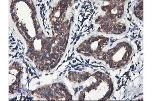 Immunohistochemical staining of paraffin-embedded Human breast tissue using anti-HMOX2 mouse monoclonal antibody. (HMOX2 Antikörper)