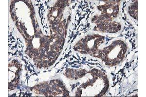 Immunohistochemical staining of paraffin-embedded Human breast tissue using anti-HMOX2 mouse monoclonal antibody. (HMOX2 Antikörper)