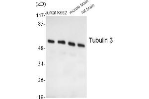 Western Blot analysis of Jurkat (1), K562 (2), mouse brain (3), rat brain (4), diluted at 1:2000. (TUBB Antikörper  (AA 370-450))