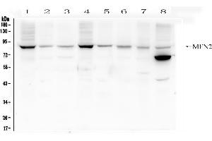 Western blot analysis of Mitofusin 2 using anti- Mitofusin 2 antibody . (MFN2 Antikörper  (AA 601-757))
