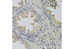 Immunohistochemistry of paraffin-embedded human prostate using LITAF Antibody (ABIN1876657) at dilution of 1:100 (40x lens). (LITAF Antikörper)