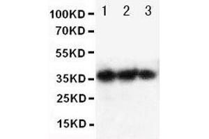 Anti-human EPO antibody, Western blotting Lane 1: Recombinant human EPO Protein 10ng Lane 2: Recombinant human EPO Protein 5ng Lane 3: Recombinant human EPO Protein 2 (EPO Antikörper  (AA 1-166))