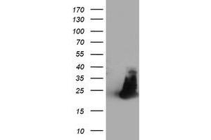 Western Blotting (WB) image for anti-Family With Sequence Similarity 119A (FAM119A) antibody (ABIN1498598) (FAM119A Antikörper)