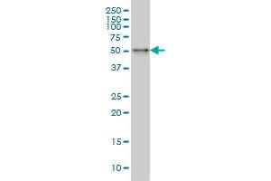 SNX4 monoclonal antibody (M01), clone 4H8 Western Blot analysis of SNX4 expression in A-431 . (Sorting Nexin 4 Antikörper  (AA 341-450))