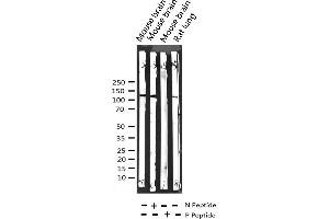 Western blot analysis of Phospho-FGFR1 (Tyr654) expression in various lysates (FGFR1 Antikörper  (pTyr654))