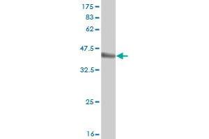 Western Blot detection against Immunogen (36. (RBCK1 Antikörper  (AA 3-99))