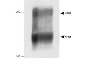 Western blot analysis of NPC1 in 20 ug of human fibroblast cell lysate with NPC1 polyclonal antibody . (NPC1 Antikörper  (AA 1230-1278))