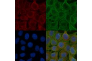 ABIN6257898 and ABIN6275911 staining Hela cells(24h of starvation treatment) by IF/ICC.