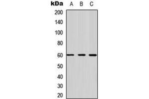 Western blot analysis of Frizzled 4 expression in HEK293T (A), Raw264.