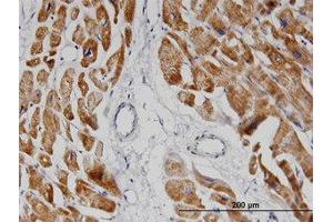 Image no. 1 for anti-NADH Dehydrogenase (Ubiquinone) 1 alpha Subcomplex, 8, 19kDa (NDUFA8) (AA 1-73) antibody (ABIN599409) (NDUFA8 Antikörper  (AA 1-73))