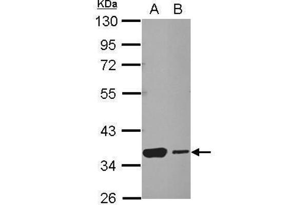 HSF2BP Antikörper