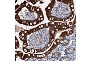 Immunohistochemical staining of human small intestine with ZNF527 polyclonal antibody  shows strong cytoplasmic positivity in glandular cells. (ZNF527 Antikörper)