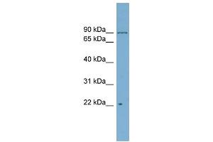 WB Suggested Anti-C12orf11  Antibody Titration: 0. (C12orf11 Antikörper  (Middle Region))