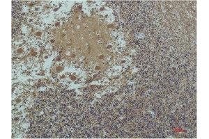 Immunohistochemical (IHC) analysis of paraffin-embedded Human Brain Tissue using a-tubulin(Acetyl Lys40) Mouse Monoclonal Antibody diluted at 1:200. (alpha Tubulin Antikörper  (acLys40))