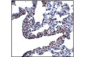 Immunohistochemistry of PCDH12 in rat lung tissue with this product at 5 μg/ml. (PCDH12 Antikörper  (N-Term))